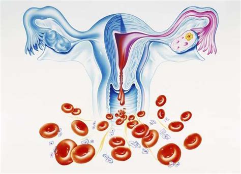 女人感染淋球菌的症状有什么？阴道分泌物异常／尿道炎／盆腔炎等